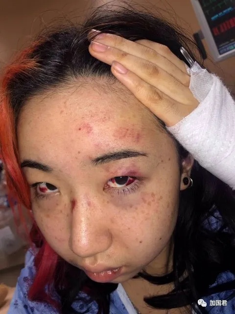 恐怖多伦多3处出现上吊绞索明天又大规模游行大批人已扎营抗议